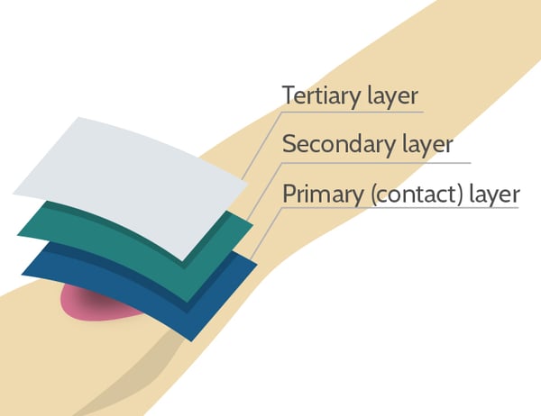 wound layers-30